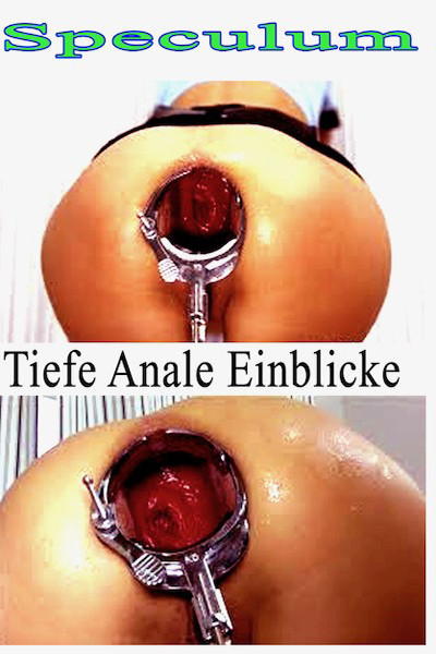 SPECULUM TIEFE ANALE EIN